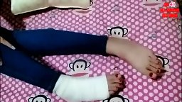 Chinese Girl With A Bandaged Ankle And Bandaged Toes